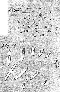 Zeichnungen von Robert Koch und Ferdinand Julius Cohn zur Keimung von Milzbrandsporen mit Optiken von Hartnack bzw. Seibert Ausschnitt aus Tafel XI, Robert Koch: Untersuchung &uuml;ber Bacterien, V. Die Aetiologie der Milzbrand-Krankheit, begr&uuml;ndet auf die Entwicklungsgeschichte des Bacillus Anthracis von Dr. Koch, Kreisphysikus in Wollstein (Ferdinand Julius Cohn [Herausgeber]: Beitr&auml;ge zur Biologie 