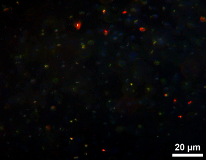 Mikroskopaufnahme mit dem Immersionsultramikroskop Nr. 32607 von Winkel-Zeiss. Zu sehen sind 50 nm gro&szlig;e Nanopartikel aus Silber
