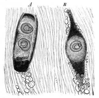 Darstellung der Lehre von den Trichinen, mit R&uuml;cksicht auf die dadurch gebotenen Vorsichtsma&szlig;regeln, f&uuml;r Laien und Aerzte; Rud.Virchow; erste Auflage; Verlag von Georg Reimer; Berlin; 1864: Fig. 3